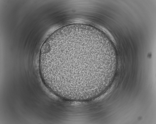 X0000116570938201001211241