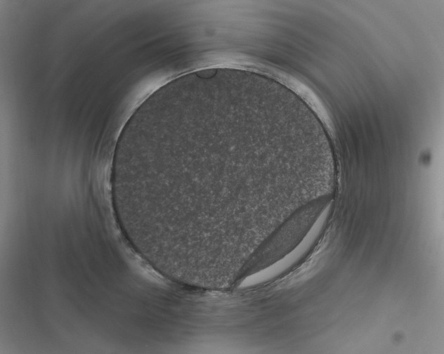 X0000116570954201001211241