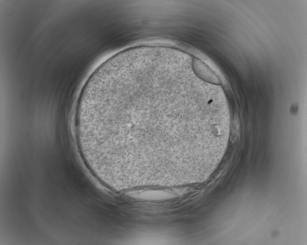 X0000116570959201001211241