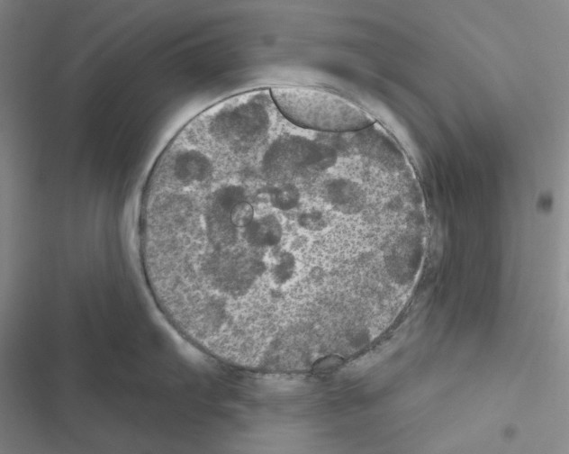 X0000116571103201001211238