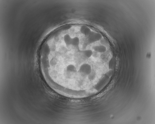 X0000116571215201001211236