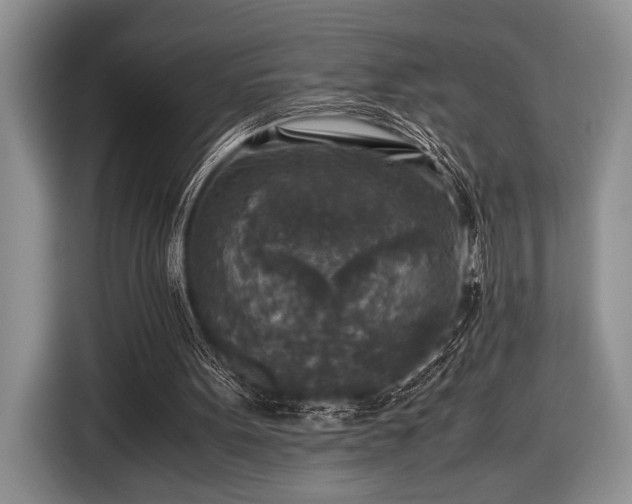 X0000116580099200912171532