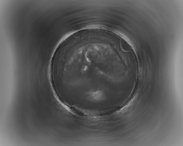 X0000116581045200912171520