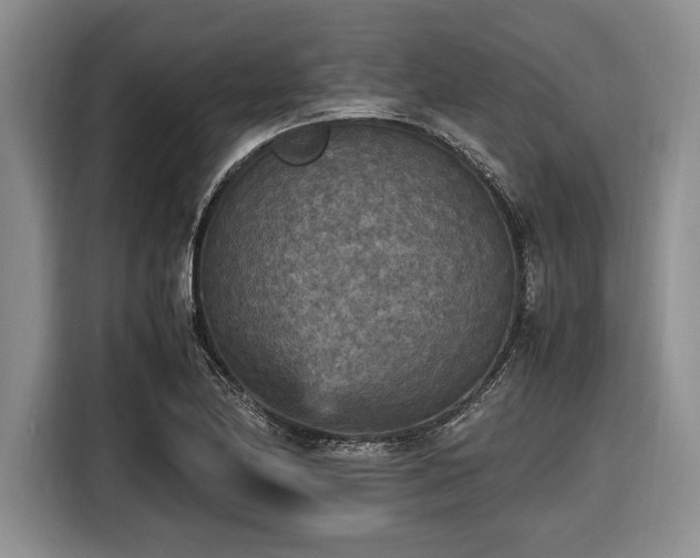 X0000116581174200912171518