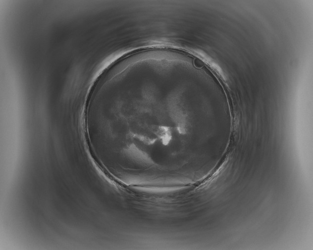 X0000116581239200912171517