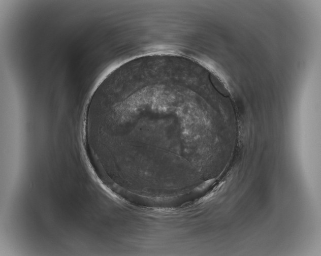 X0000116581383200912171515