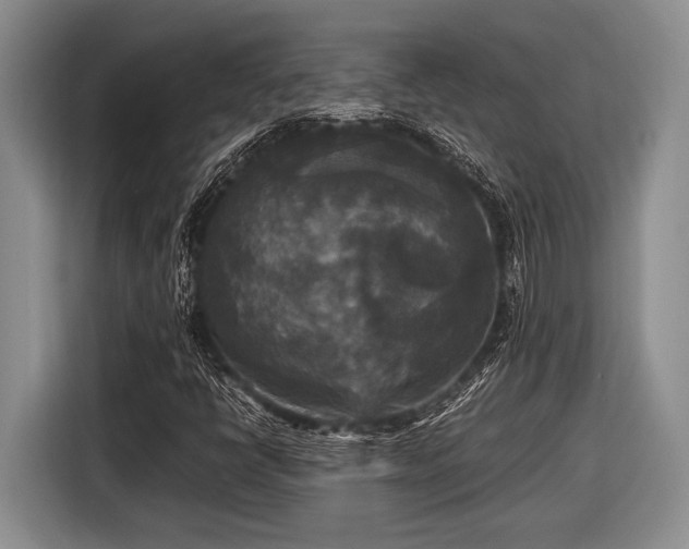 X0000116581398200912171514