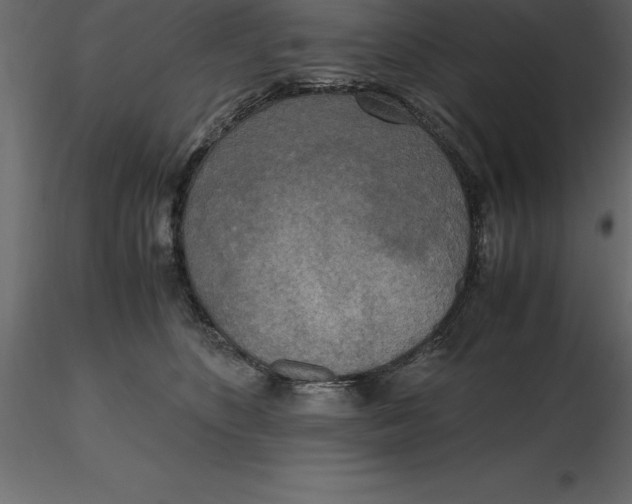 X0000116580516200912312017