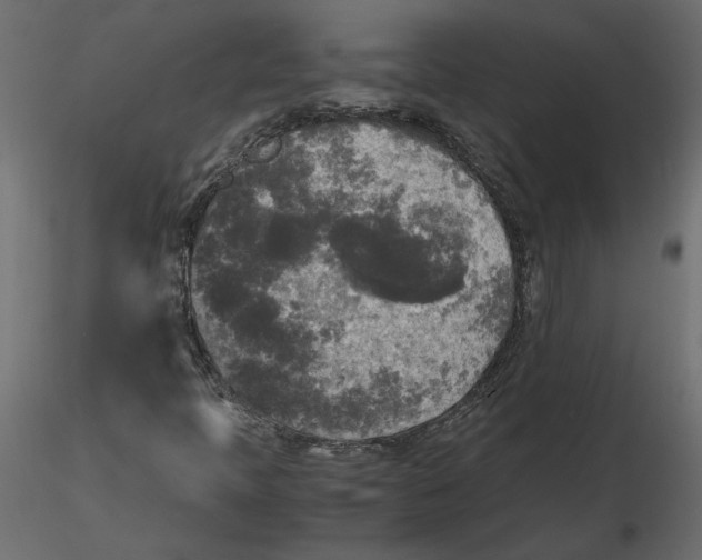 X0000116581397200912312004