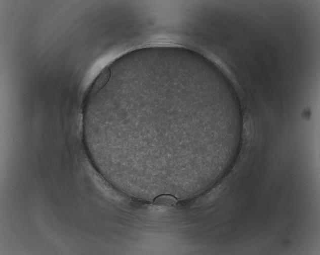 X0000116581461200912312004