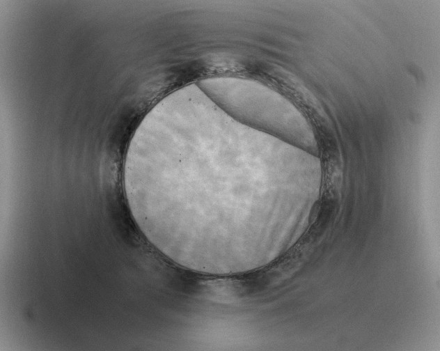 X0000116580417201001071218