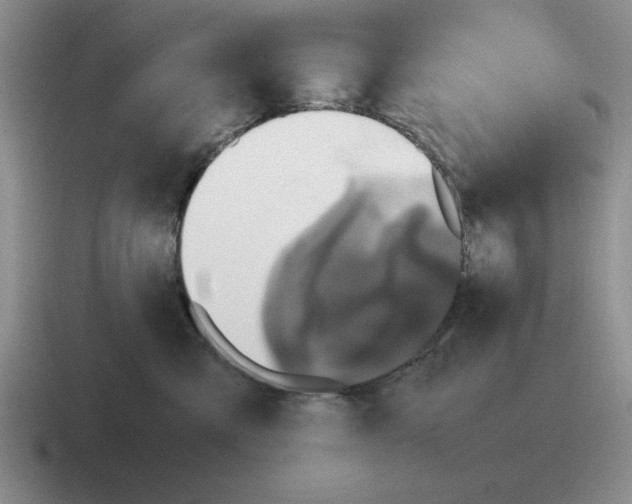 X0000116580427201001071218