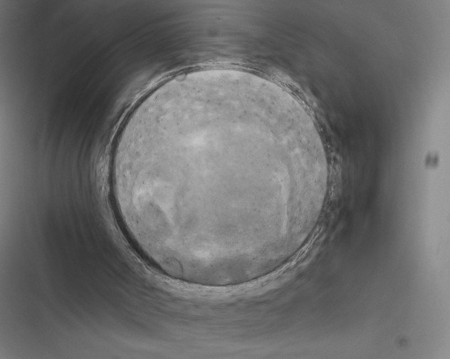 X0000116580002201001211314
