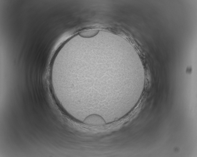 X0000116580006201001211314