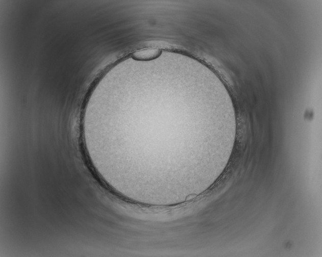 X0000116580015201001211314