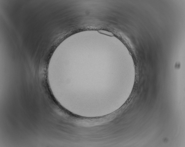 X0000116580017201001211314