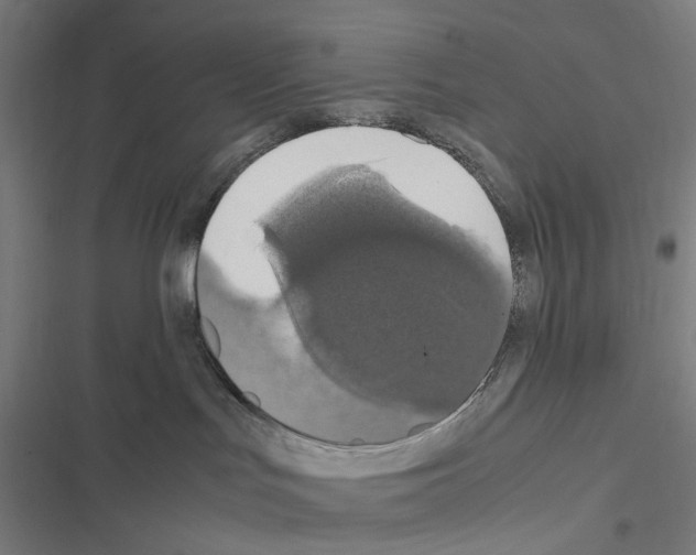 X0000116580047201001211314
