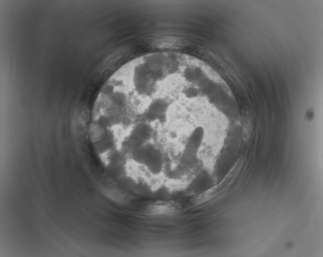 X0000116580175201001211312