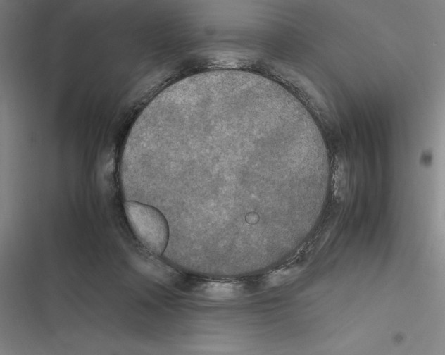 X0000116580314201001211310