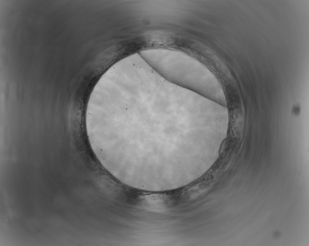 X0000116580417201001211308