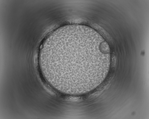 X0000116580638201001211305