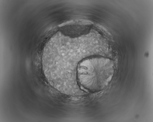 X0000116580917201001211301