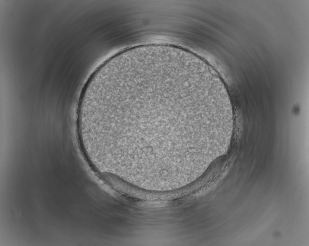 X0000116581134201001211259