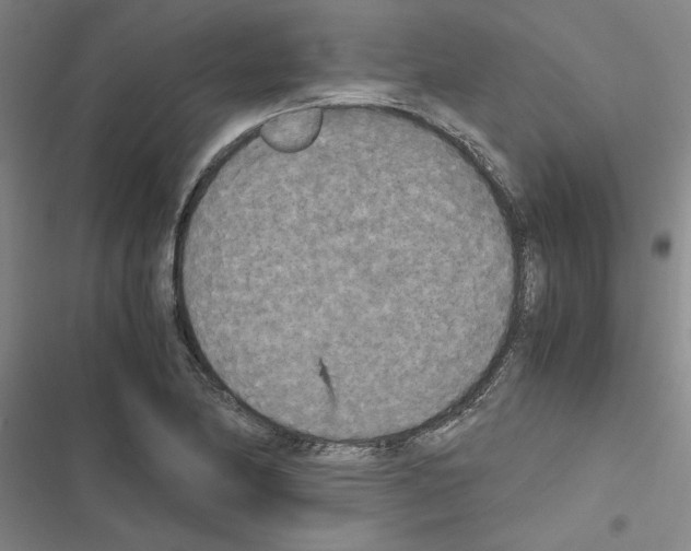 X0000116581174201001211258