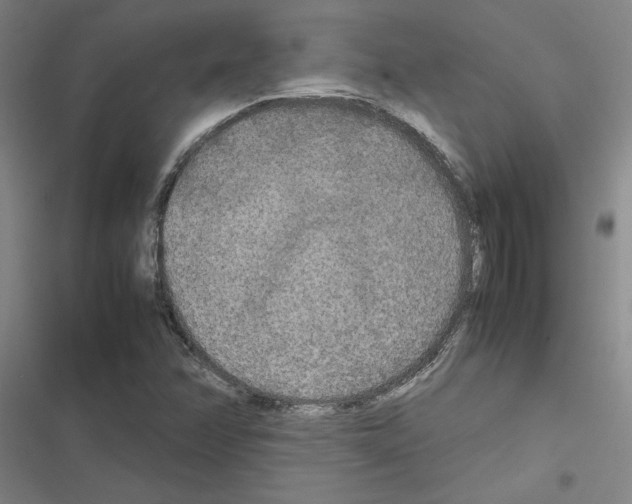 X0000116581358201001211256