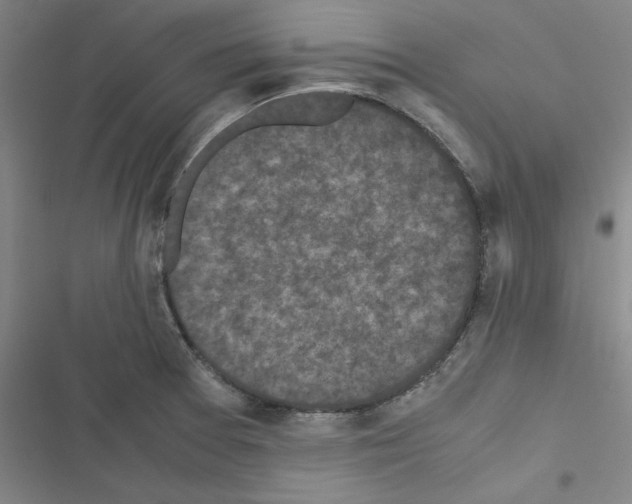 X0000116581377201001211255