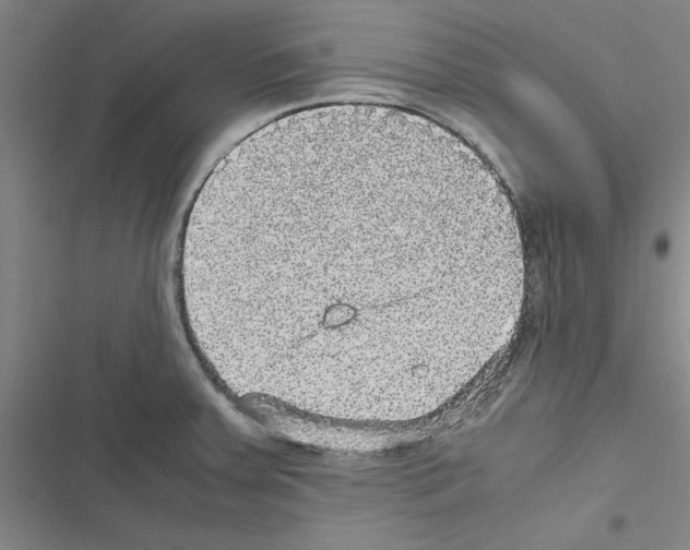 X0000116581379201001211255