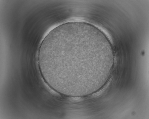 X0000116581382201001211255