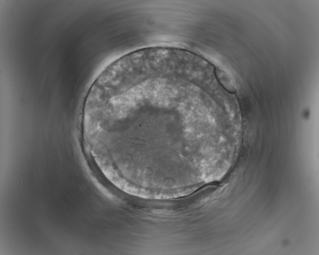 X0000116581383201001211255