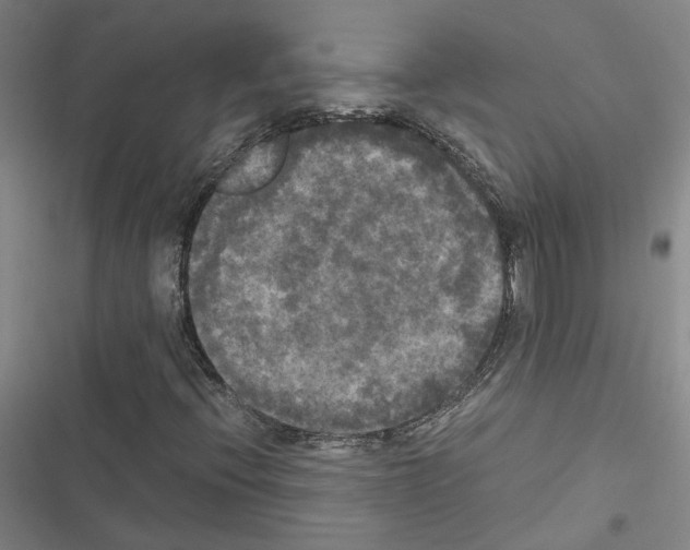 X0000116581396201001211255