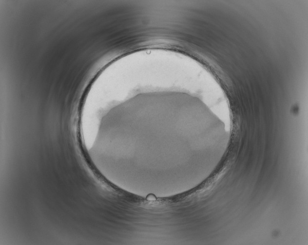 X0000116581418201001211255