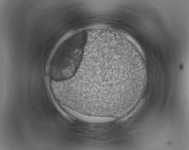 X0000116581437201001211255