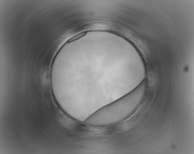 X0000116581473201001211254