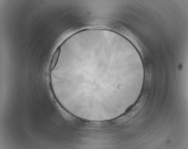 X0000116581485201001211254