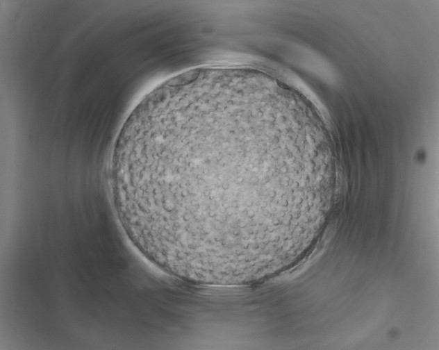 X0000116581487201001211254