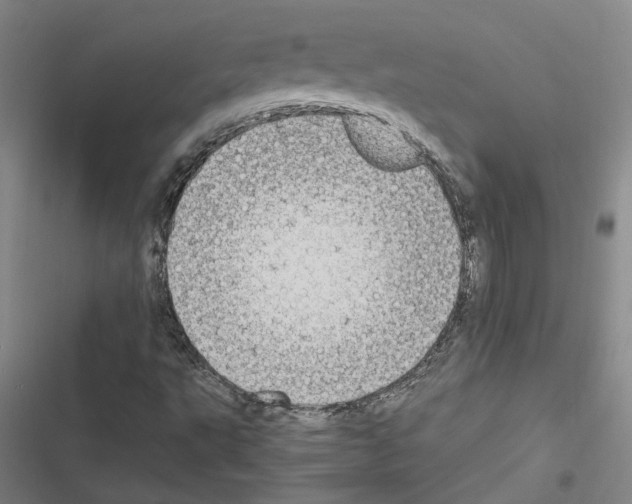 X0000116581495201001211253
