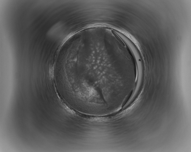 X0000116590953200912171551