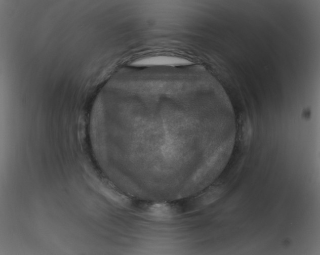 X0000116590562200912312038