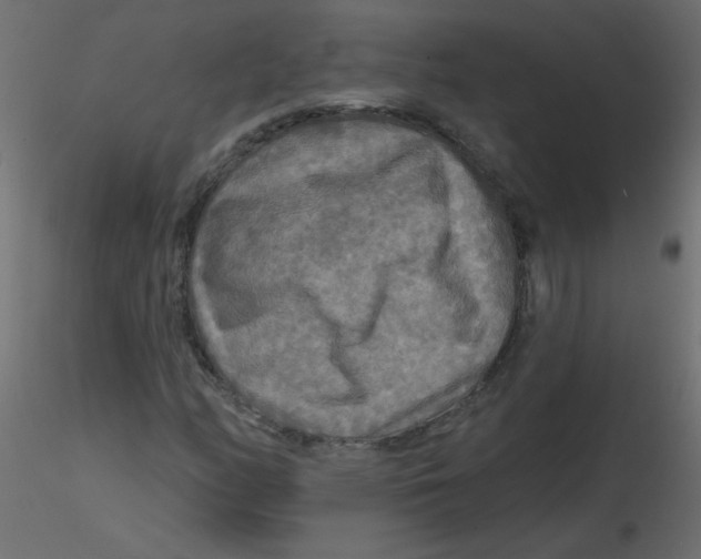 X0000116591158200912312030