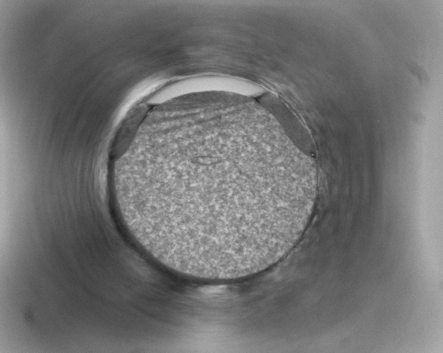 X0000116590054201001071242