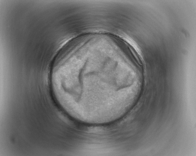 X0000116590105201001071241