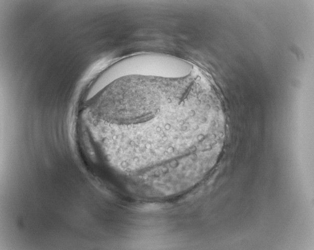 X0000116590149201001071240