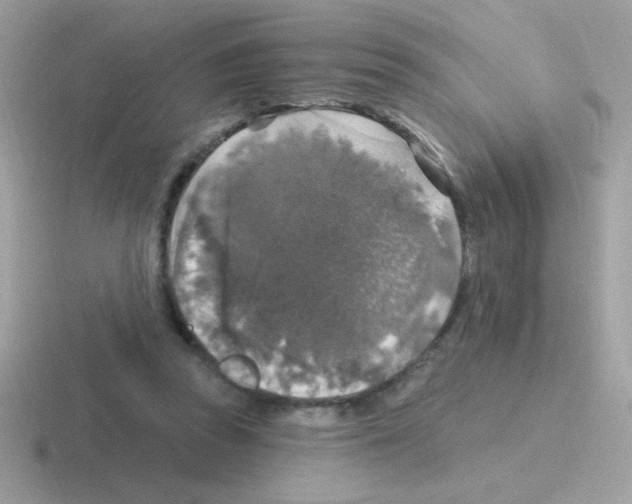 X0000116590353201001071238