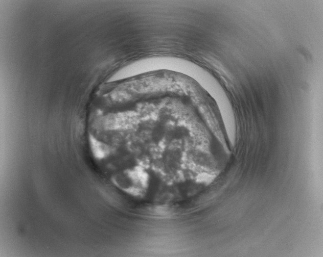 X0000116590365201001071238