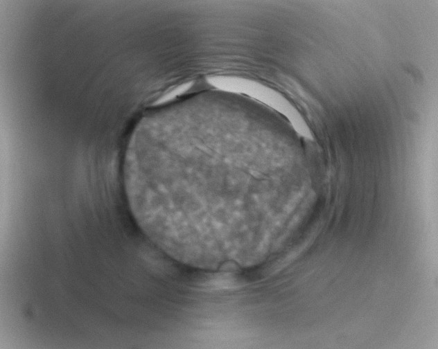 X0000116590377201001071238