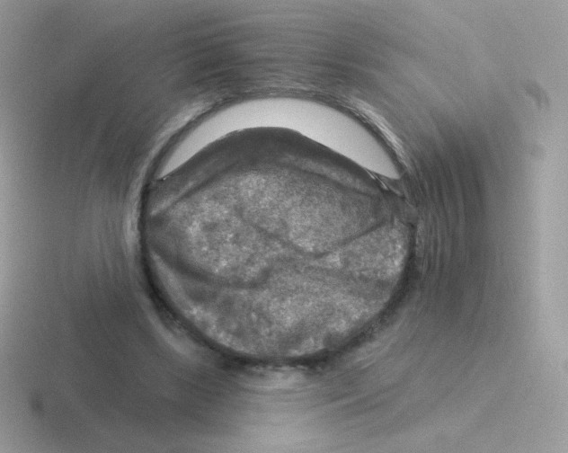 X0000116590443201001071237